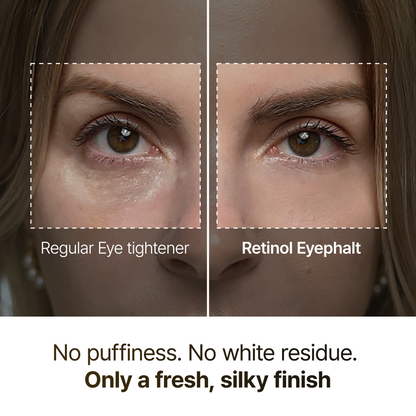 [FLASH 1+1 DEAL] Retinol Eyebag Cream